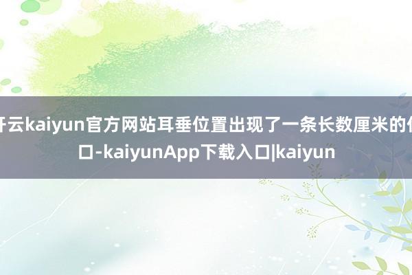 开云kaiyun官方网站耳垂位置出现了一条长数厘米的伤口-kaiyunApp下载入口|kaiyun